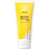 TOUCH - Gel de Traitement de L'acné - Peroxyde de Benzoyle 2,5%, 227g